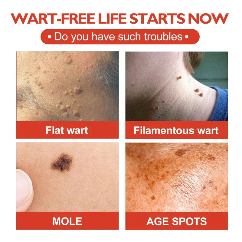 Skin Tag and Mole Remover Patch