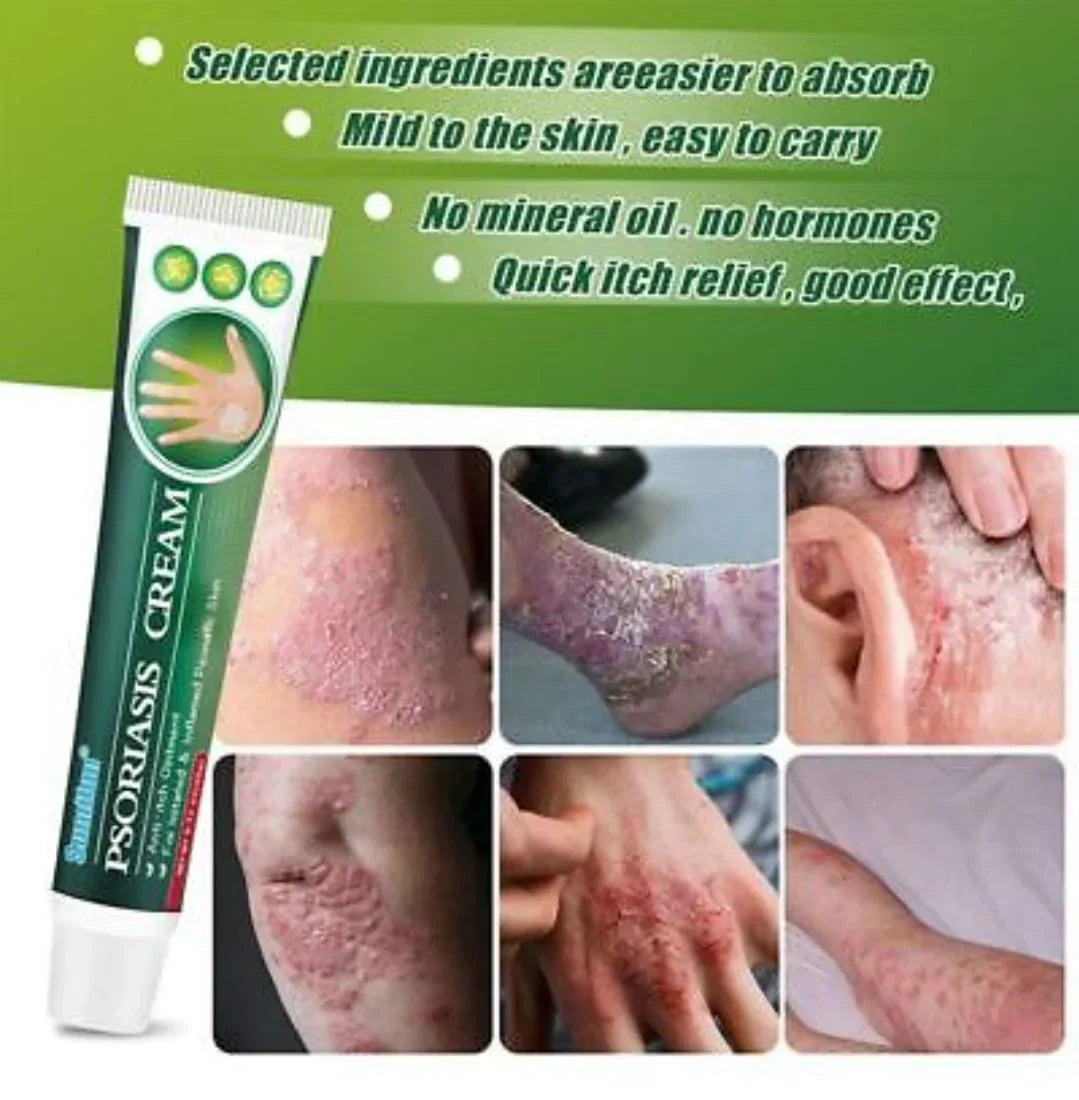 Psoriasis Cream