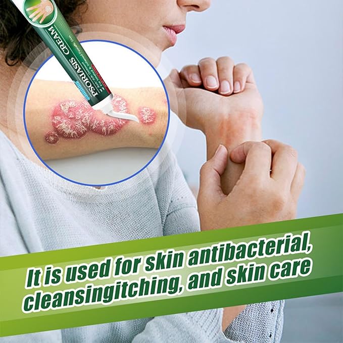 Psoriasis Cream