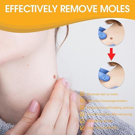 Wart & Tag Remover - Bee Venom Repair Spray