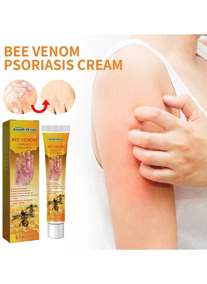 Bee Venom Psoriasis Care Cream