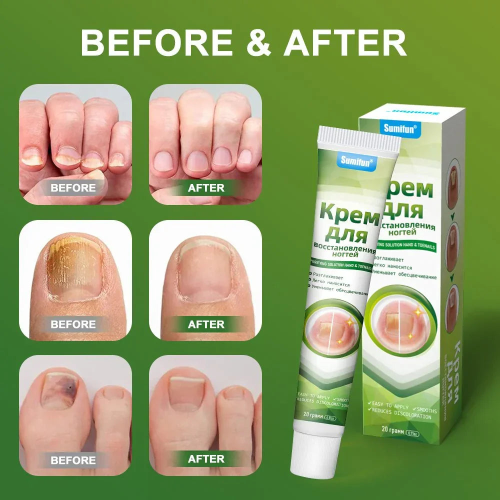Nail Treatment Repair Gel