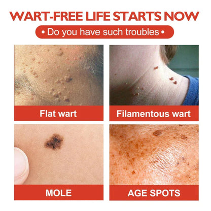 Skin Tag and Mole Remover Patch